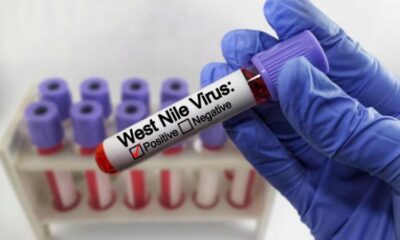 Alertă la Brăila. Un deces și patru cazuri de meningită West Nile featured image