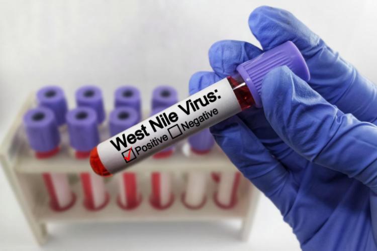 Alertă la Brăila. Un deces și patru cazuri de meningită West Nile featured image