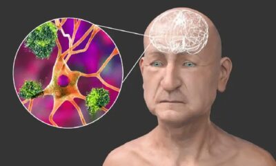 Ce trebuie să faci pentru a reduce riscul de demență la vârsta a treia