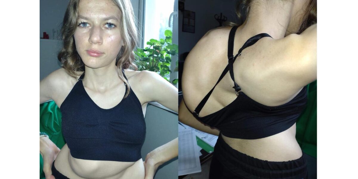 „Nu cred că mai apuc să termin liceul”. La 17 ani, Denisa are nevoie de ajutor pentru o operație în Turcia