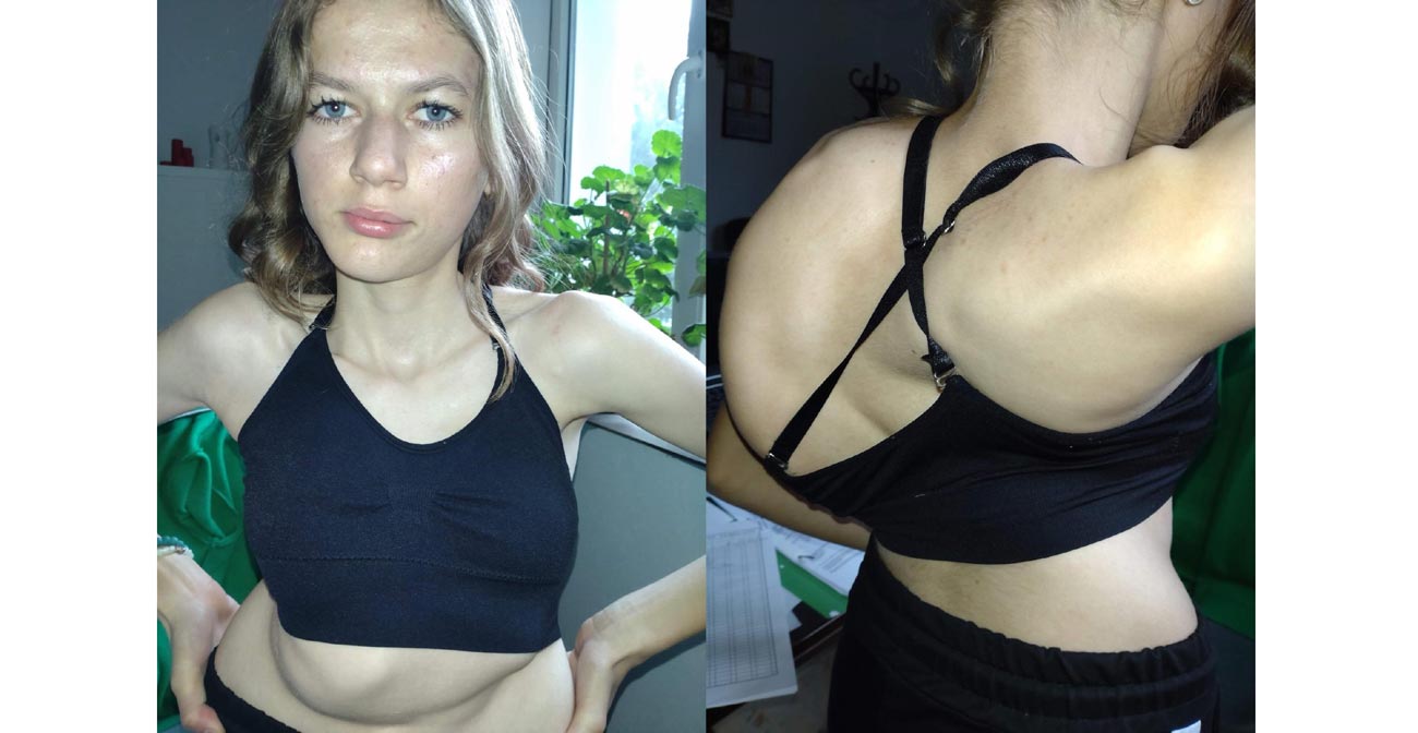 „Nu cred că mai apuc să termin liceul”. La 17 ani, Denisa are nevoie de ajutor pentru o operație în Turcia