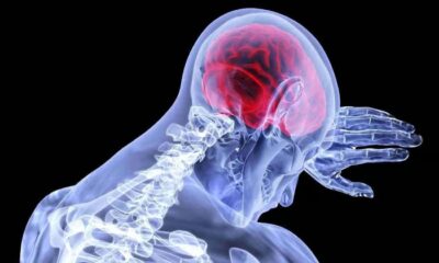 Semnele unui accident vascular cerebral pe care nu trebuie să le ignori. Ce trebuie făcut în primele minute