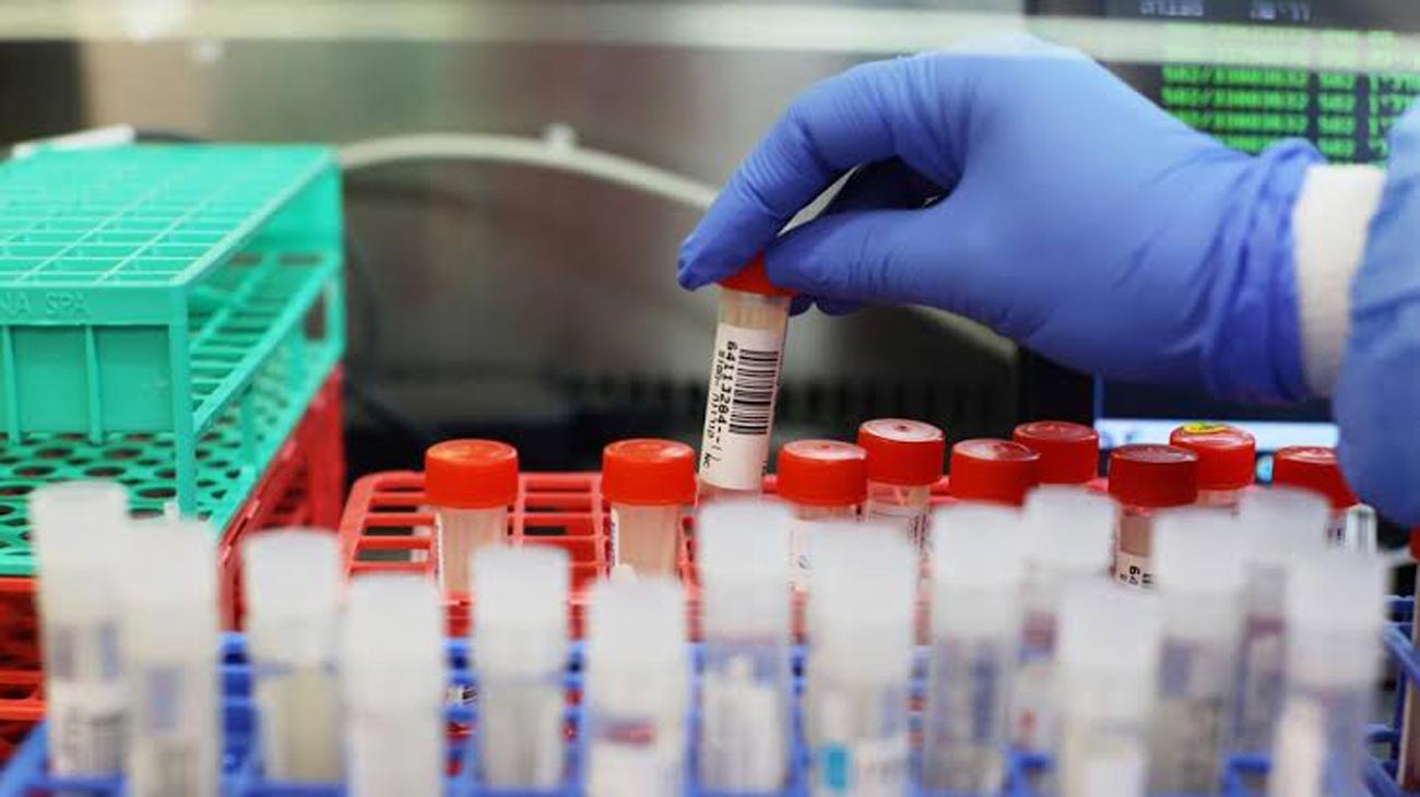 Inteligența artificială, folosită în experimente cu virusuri periculoase